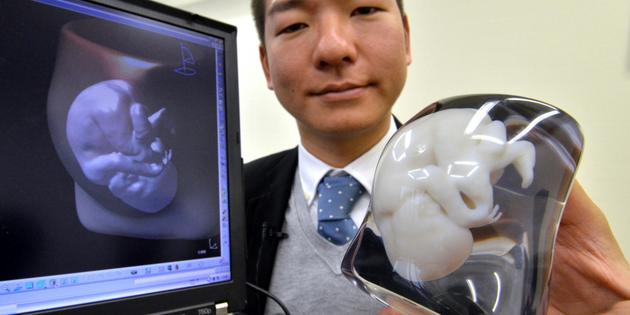 Comme souvenir de grossesse, une reproduction de foetus en 3D