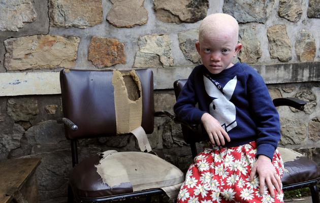 Une enfant albinos au Burundi, en 2009 [Stephane de Sakutin / AFP/Archives]