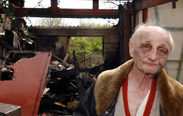 Paul Voise, visage tuméfié, devant sa maison incendiée, le 20 avril 2002 à Orléans [Alain Jocard / AFP/Archives]