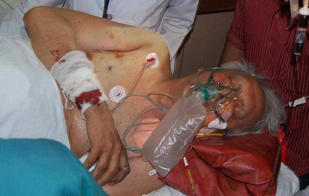 Un homme blessé lors de l'attaque d'un convoi d'élus par des maoïstes est pris en charge par des médecins, le 26 mai 2013 à Raipur [Strdel / AFP]